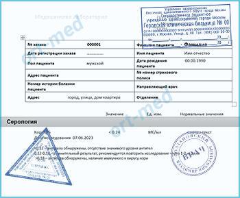 Купить тест на антитела к вирусу кори Купить справку тест на антитела к вирусу кори в Балашихае официально